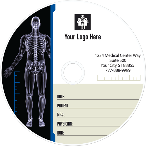 112_xray_vision_beige picture of cd custom printed for medical imaging
